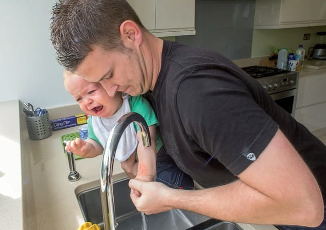Man holding baby and running baby's arm with burn mark under water in kitchen sink